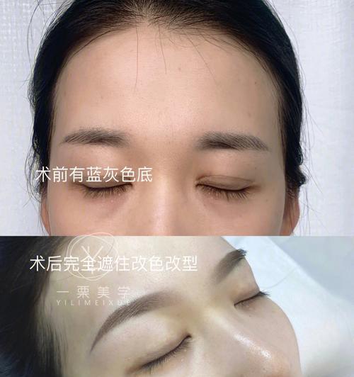 手术后显示屏颜色变化代表什么？各颜色含义是什么？